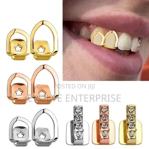 Gold Plated Grillz