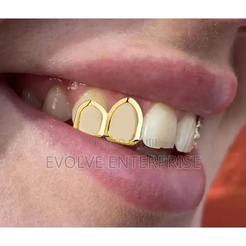 Gold Plated Grillz