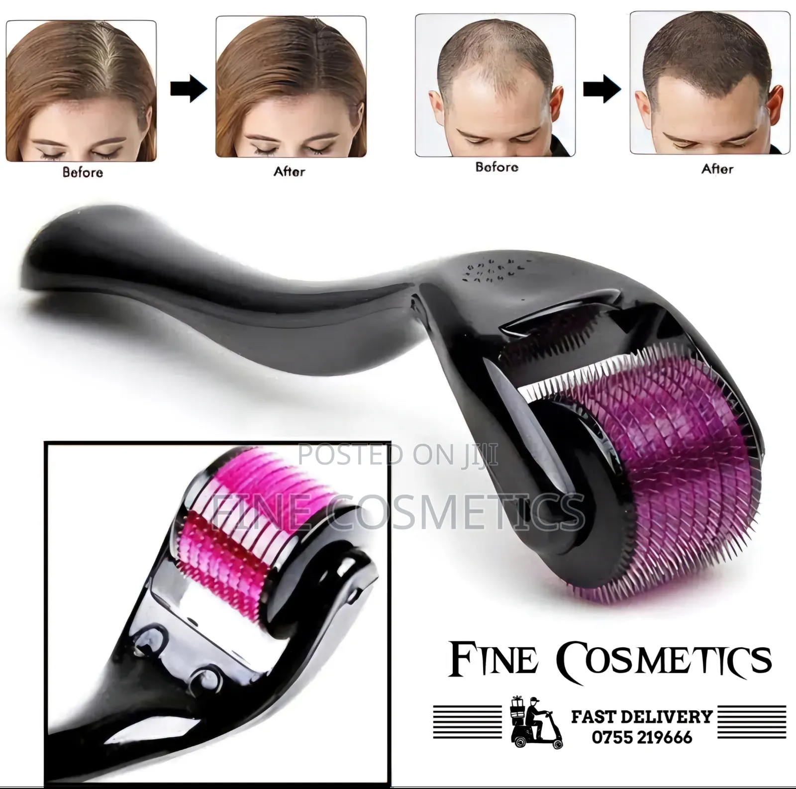 DERMA ROLLER SYSTEM, For Hair + Skin, Cell Regeneration Tool