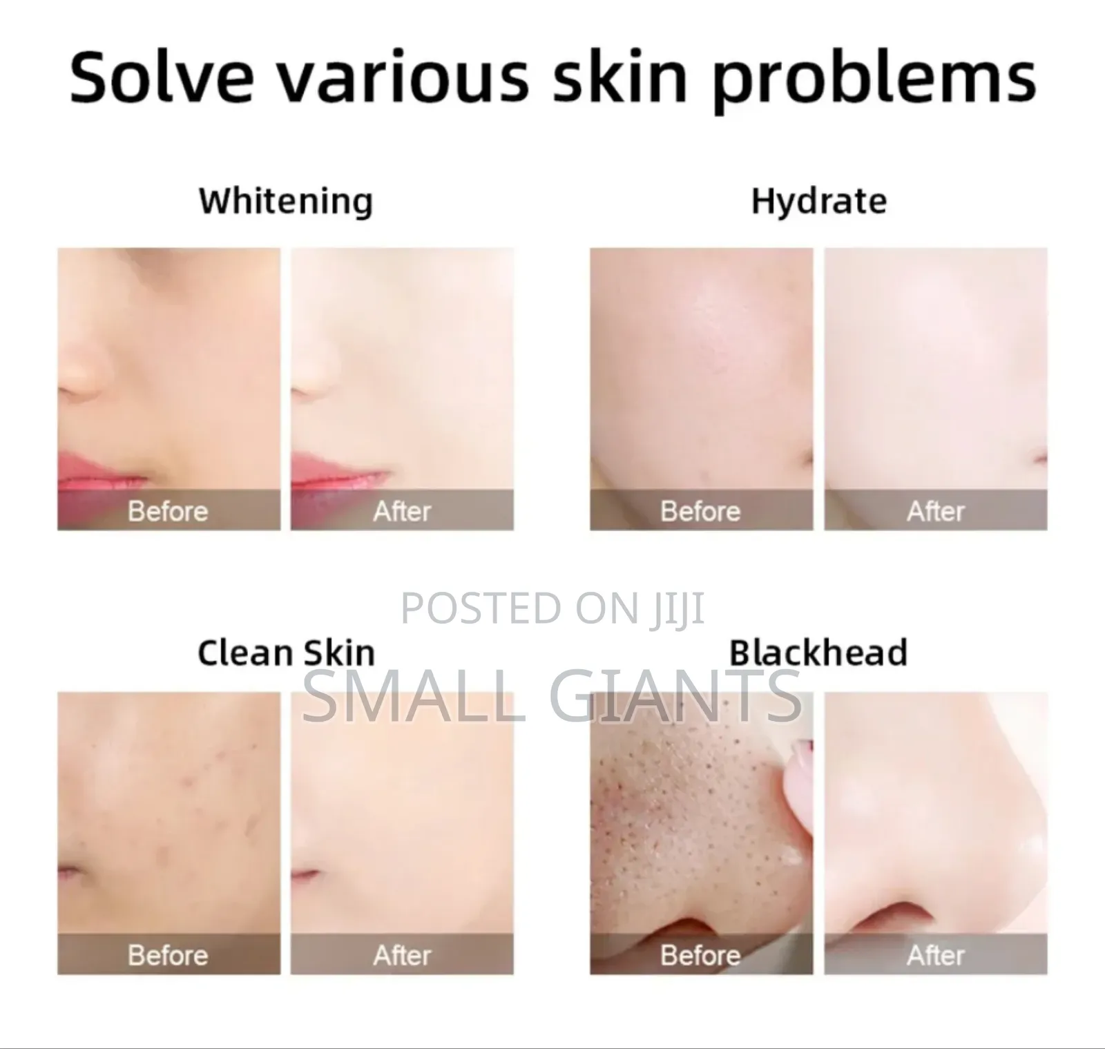 H2O Small Bubble Skin Care Device
