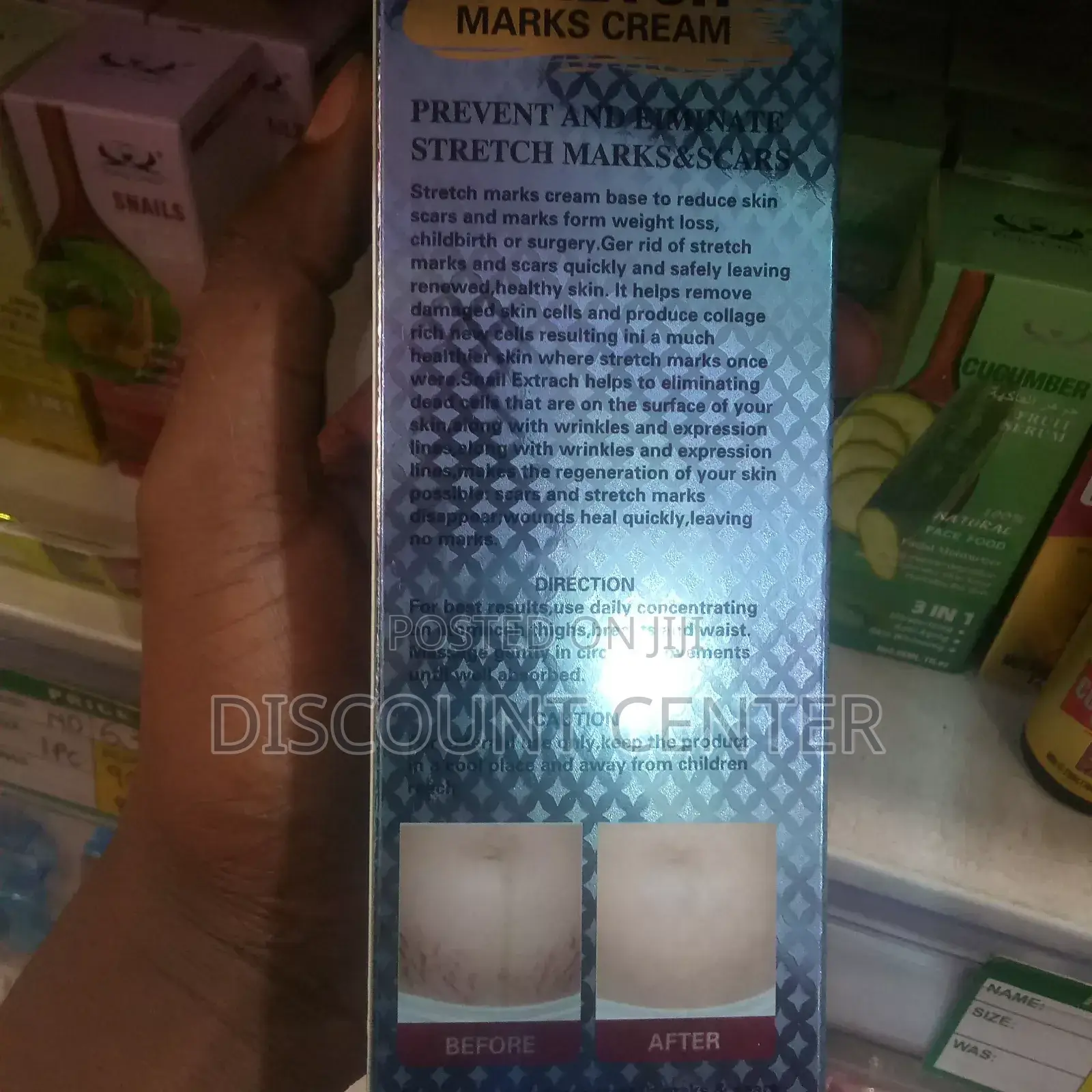 Stretch Marks Remover