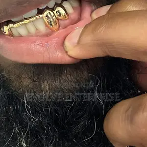 Gold Teeth Grills