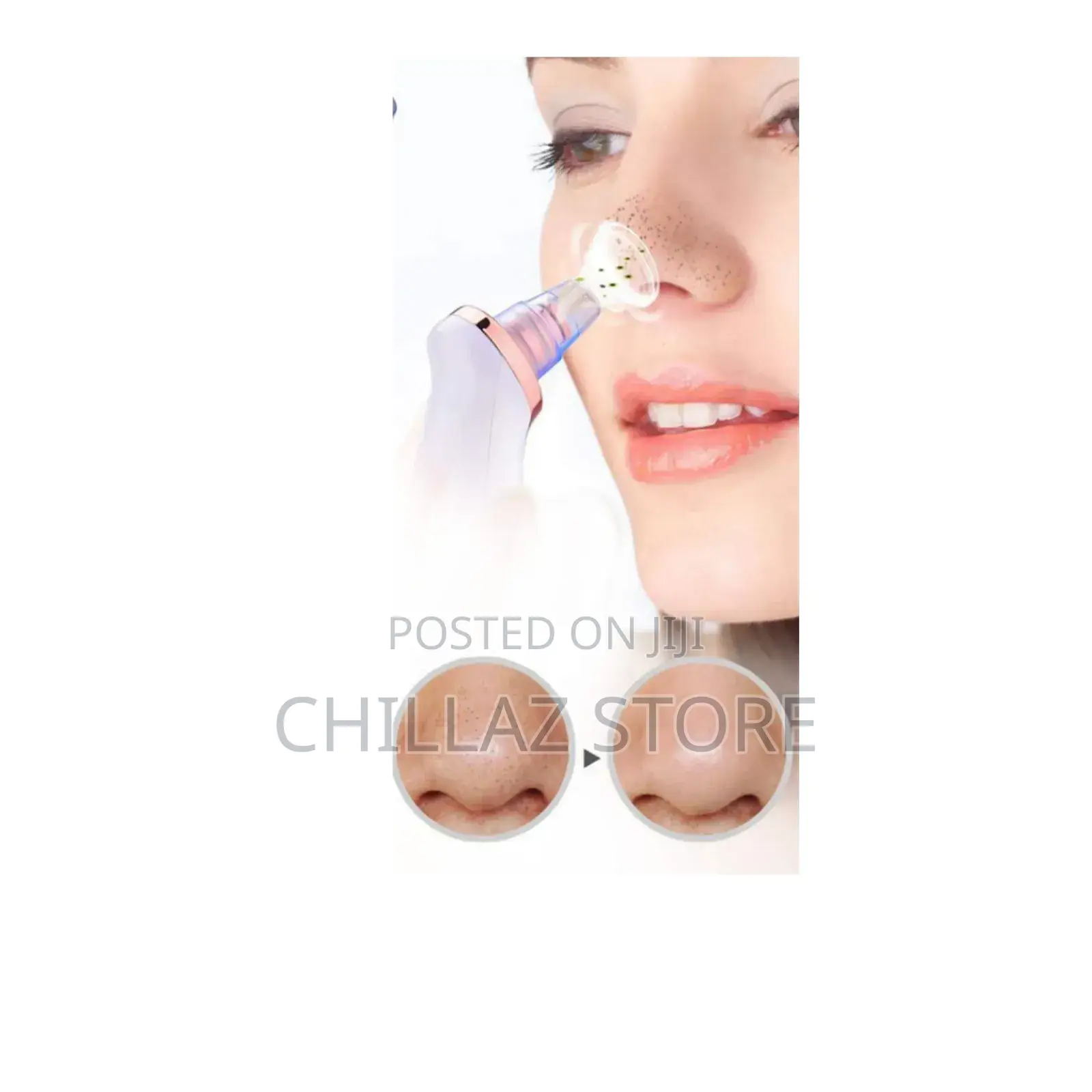 Blackhead Remover Machine.