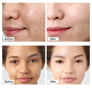 Retinol Face Cream