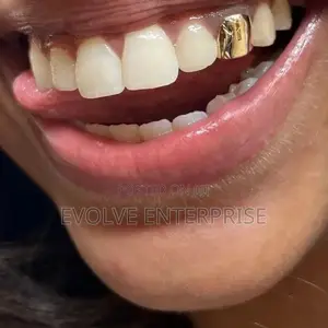 1PC Hip Hop Gold Color Metal Braces Grillz