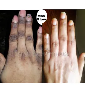 Dark Knuckles Cream