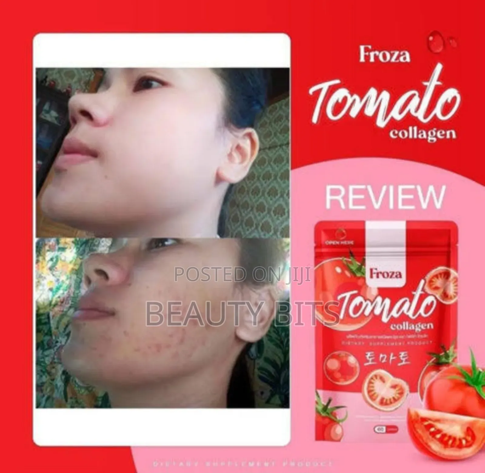 Tomato Froza Collagen