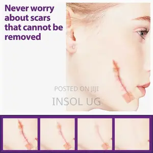 Silicone Scar Remover