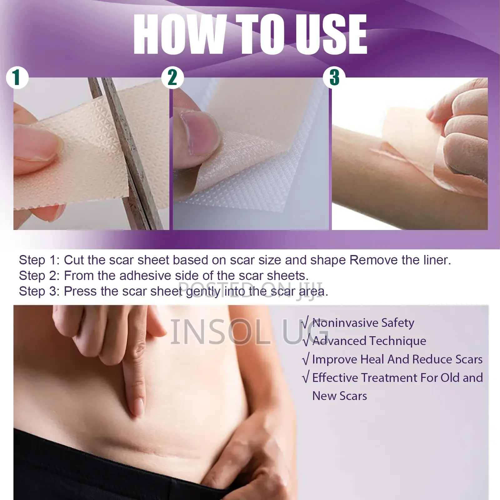 Silicone Scar Remover