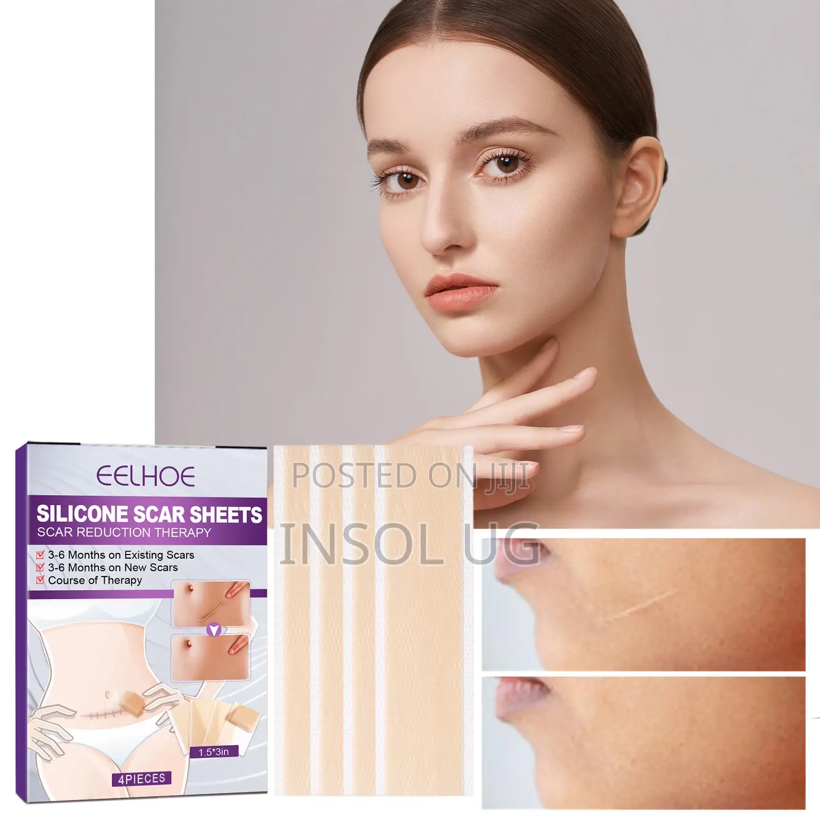 Silicone Scar Remover