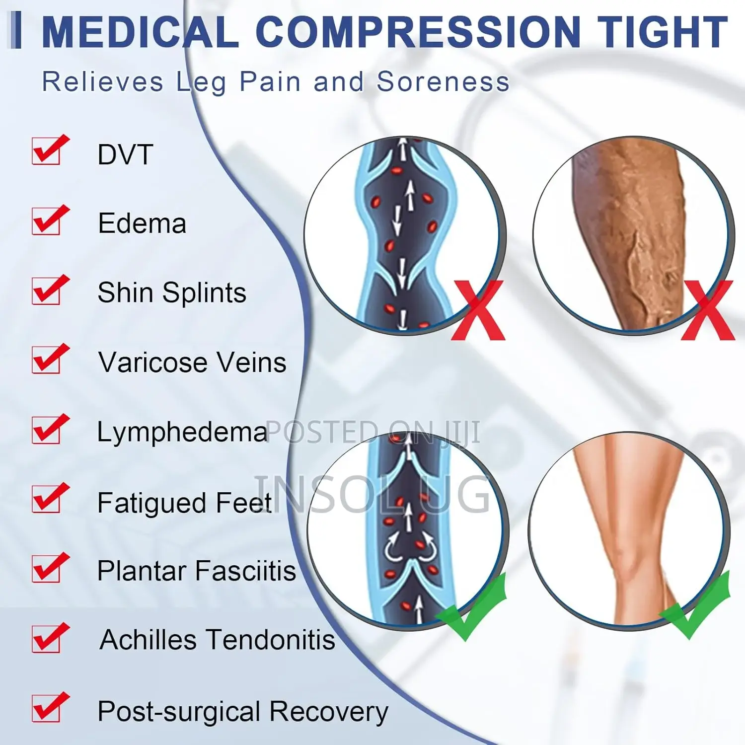 High Waist Medical Stockings