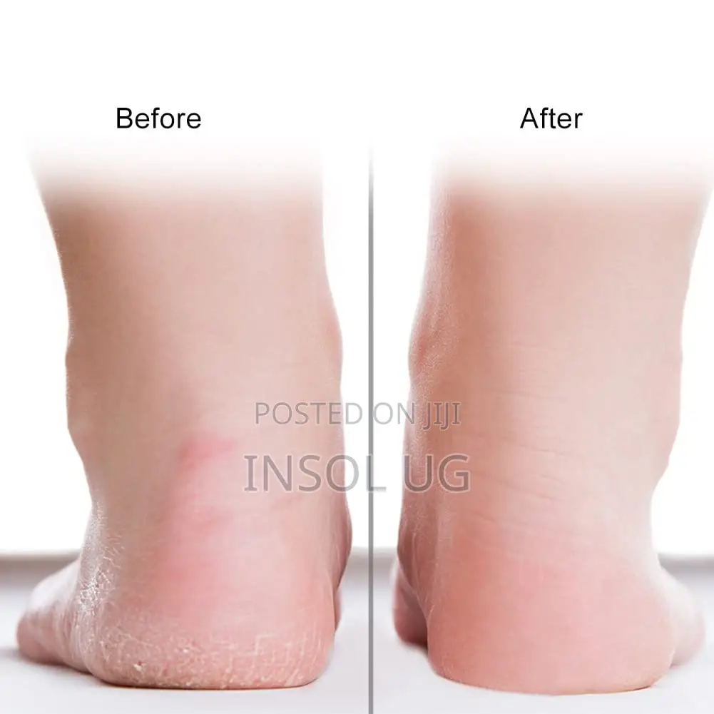 Silicone Gel Moisturizing Socks - Foot Anti-cracking