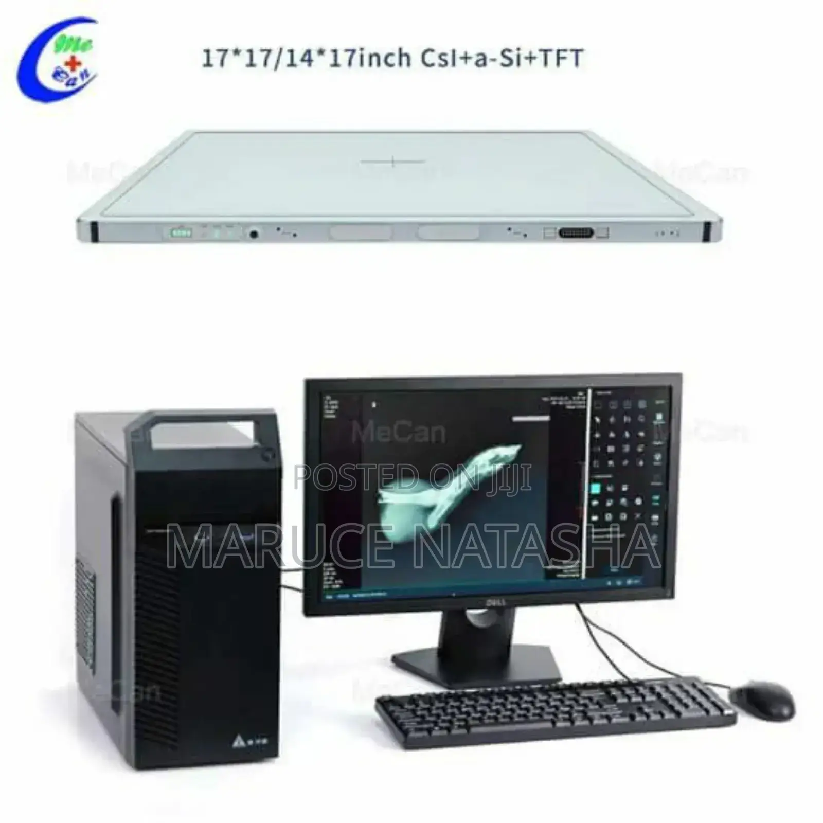 High Frequency Digital Gastrointestinal and DR X-Ray System