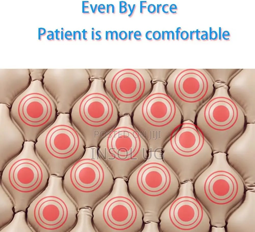 Alternating Pressure Pressure Relief Mattress.