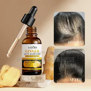 Ginger Anti-Hair Loss Oil Essence 30ml