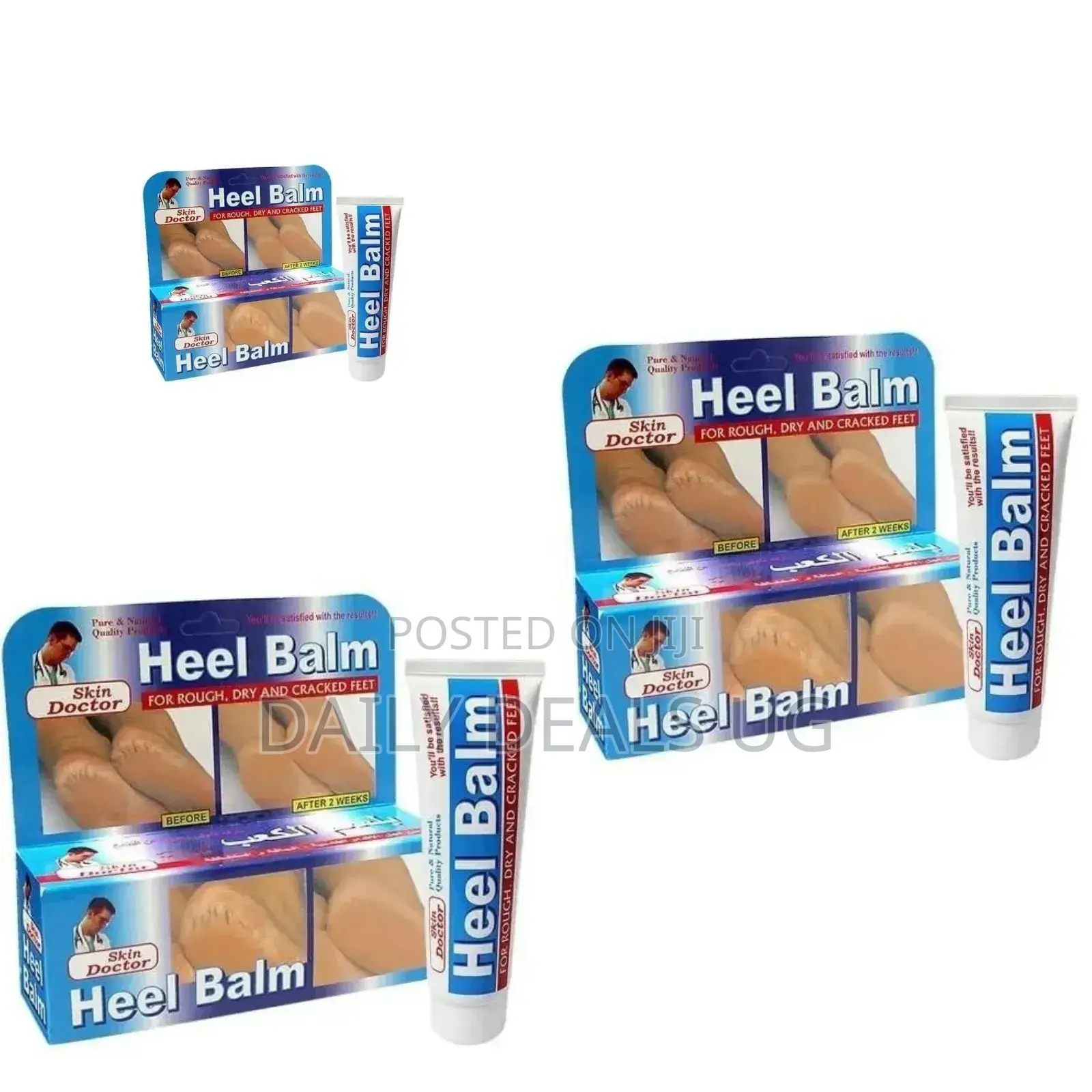 Foot Heel Balm