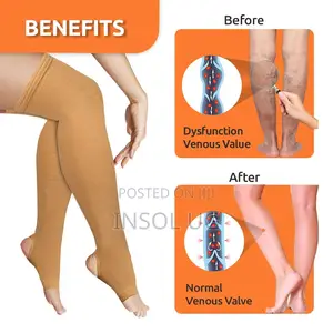 Varicose Vein Stockings for Swollen, Tired, Aching Legs Etc