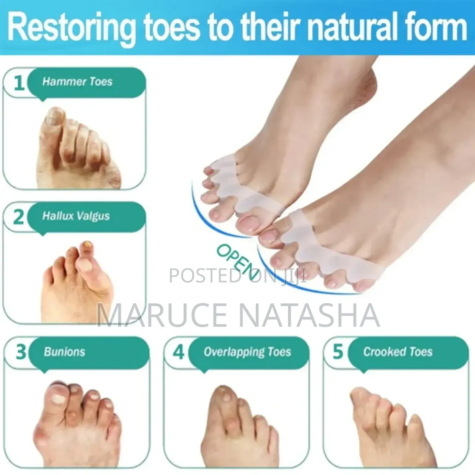 Toe Separators