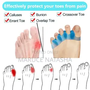 Toe Separators
