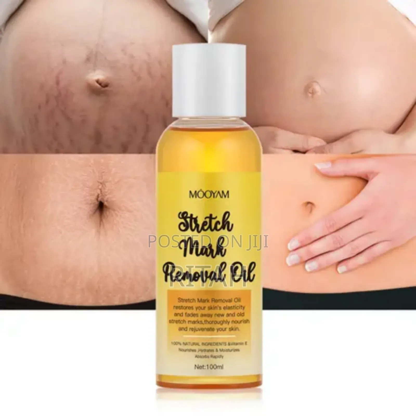 Stretch Mark Romoval Oil