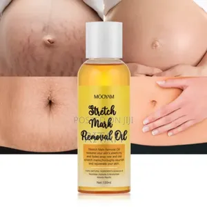 Stretch Mark Romoval Oil