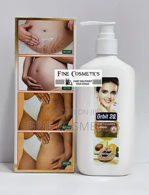 ORBI 20 STRETCH MARKS LOTION, Cocoa Butter Anti-Stretch Mark