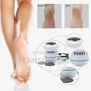 Rechargeable Callus Remover