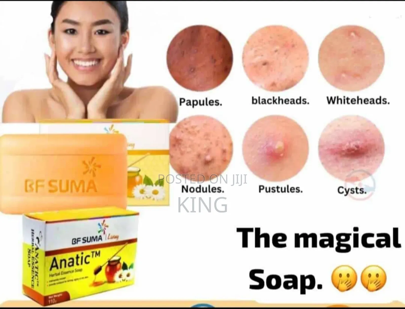 Anatic Herbal Soap