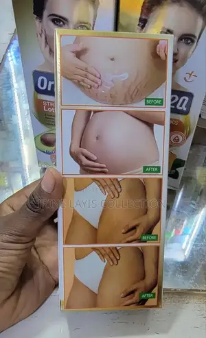 Orbit 2q Stretch Mark Lotions