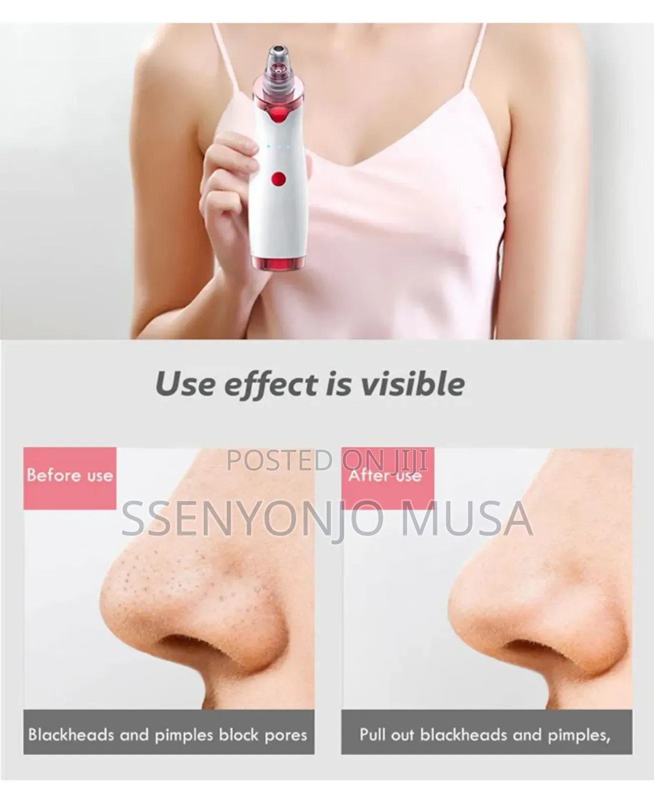Blackhead Remover Skincare Tool Kit