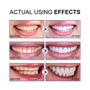 2pcs Eelhoe Herbal Mint Dental Teeth Whitening Powder