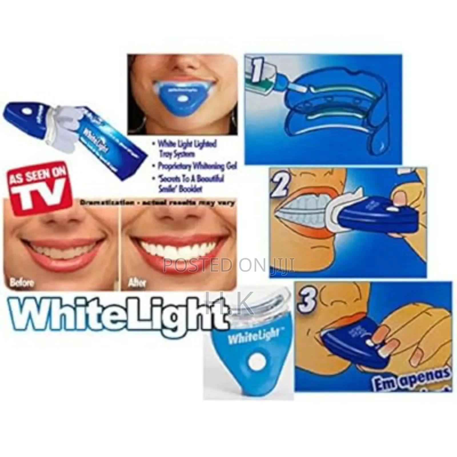 Teeth Whitening and Treatment Kit