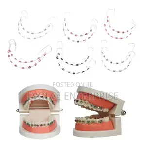 1pair Colorful Temporary Tooth Braces With Metal Wires