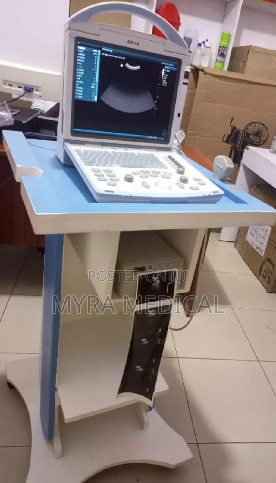 Mindray Dp 10 Ultrasound Scan