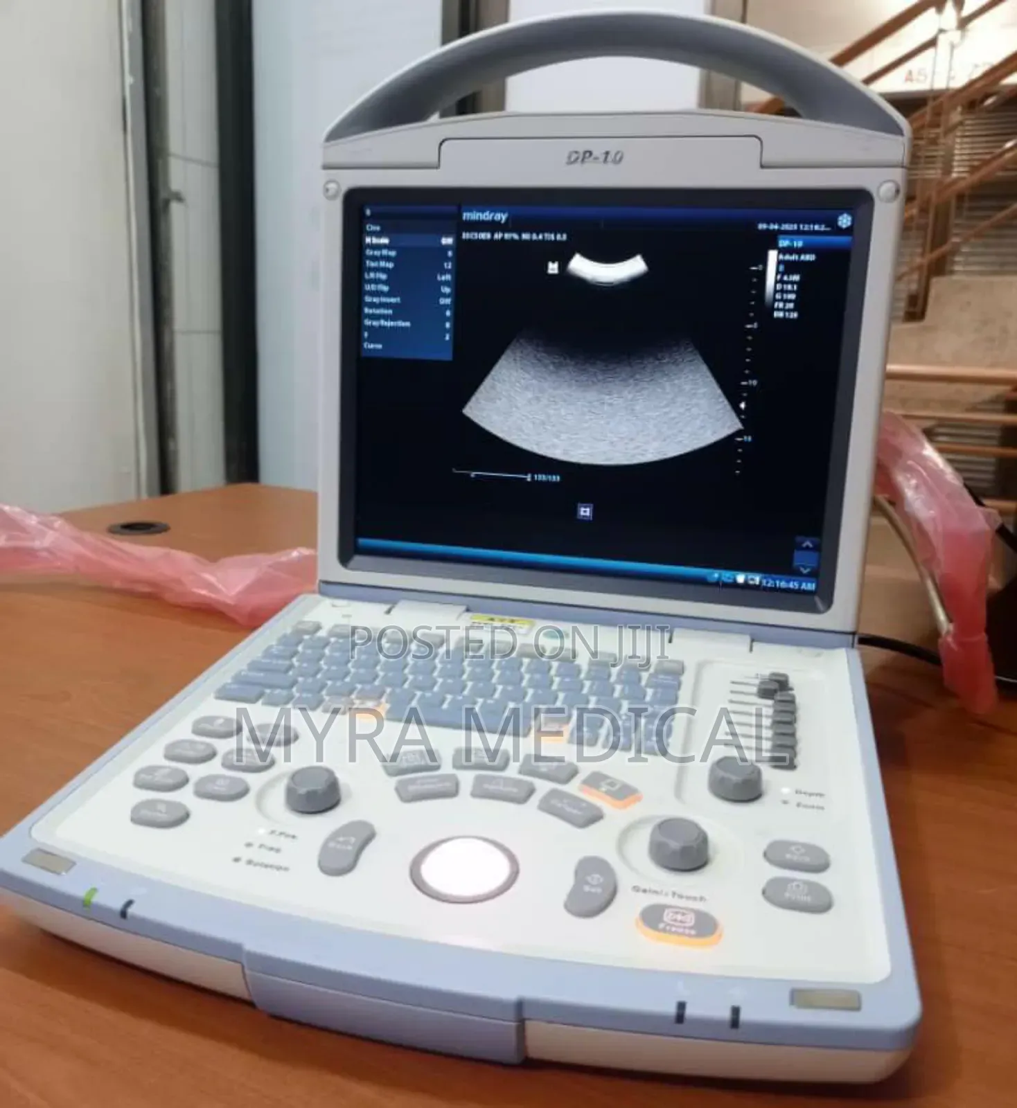Mindray Dp 10 Ultrasound Scan