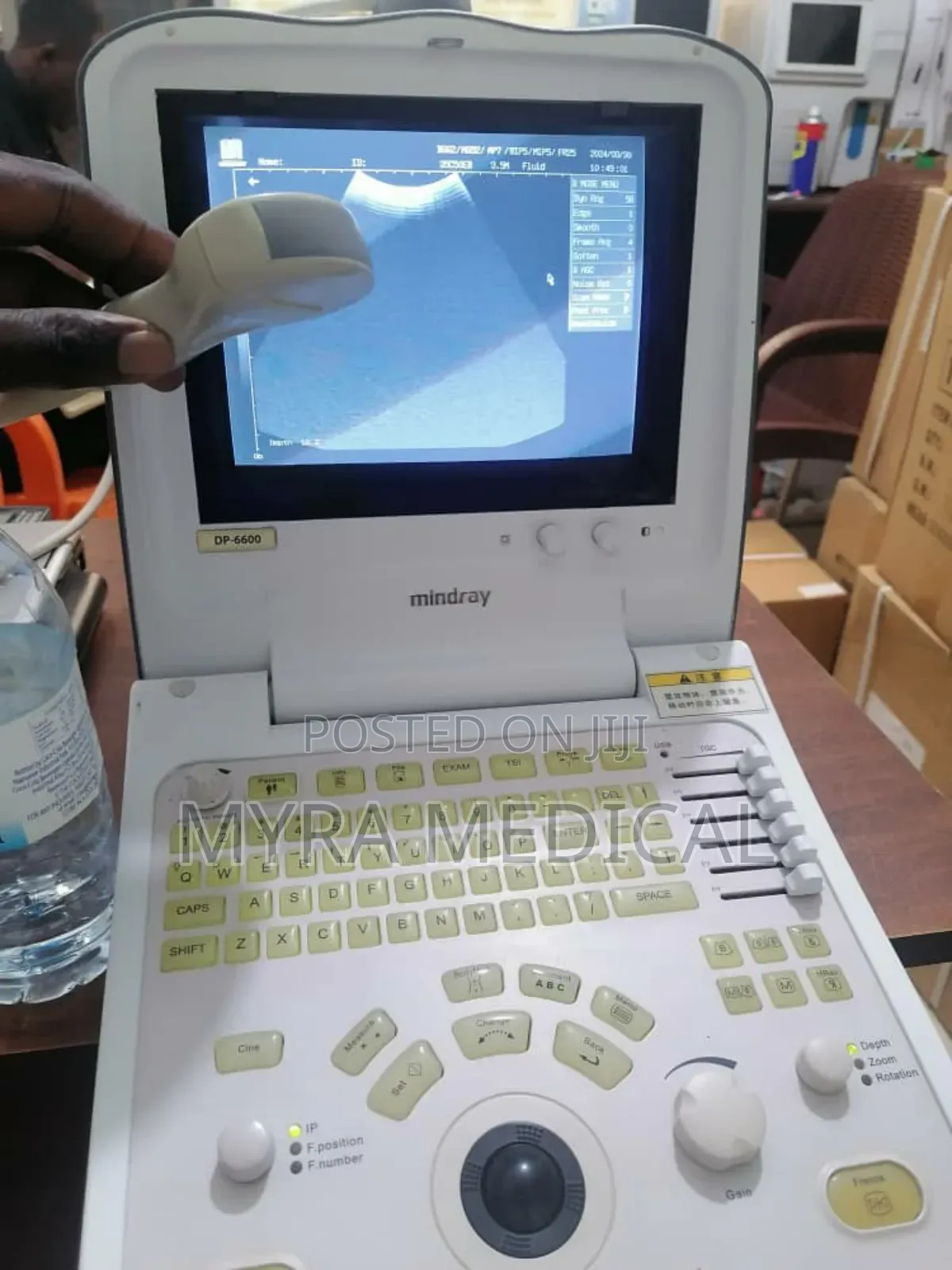 Mindray Dp6600 Ultrasound Scan