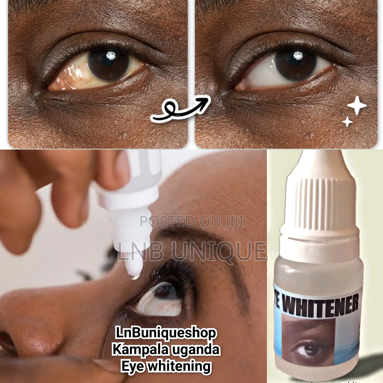 Eye Whitening