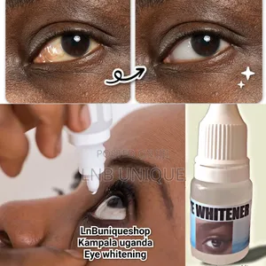 Eye Whitening