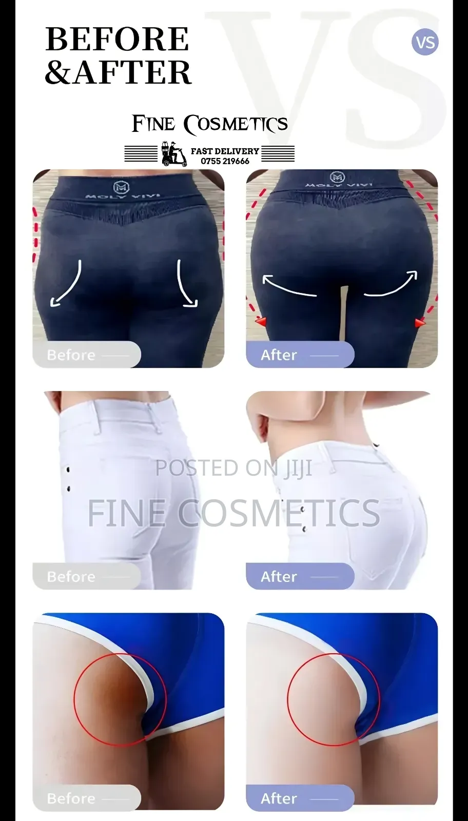 Wholesale Hip and Butt Enhancement Gummies Natural Curves