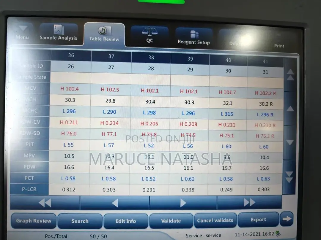 High Quality Bc20 CBC Machine (Hematology Analyzer)