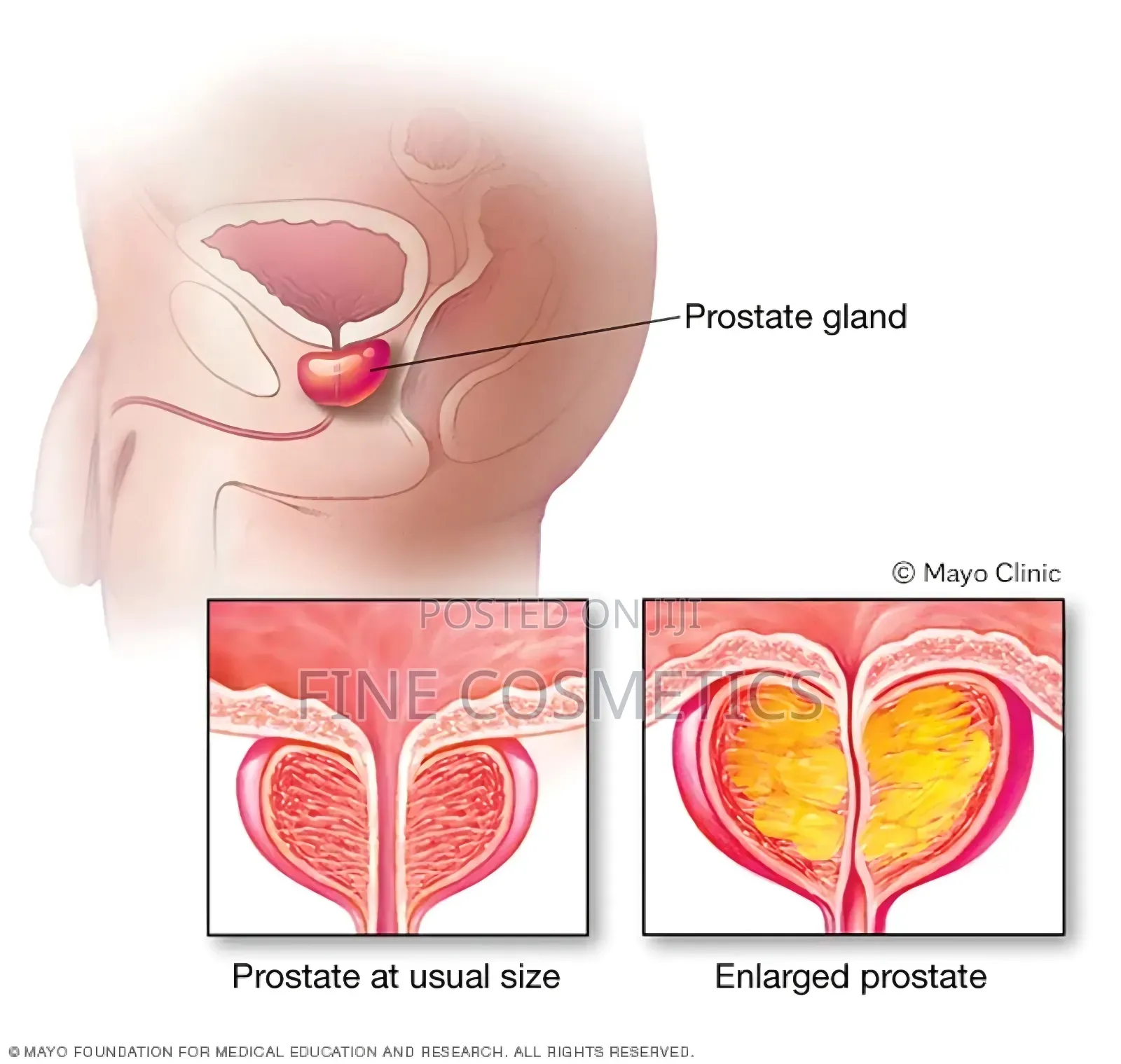 Prostate Tablets, Men's Healthy Enlarged Prostate Care Pills
