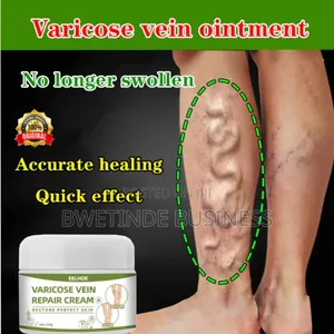 Varicose Veins Cream, Spider Veins Repair Cream