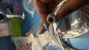 Spo2 Patient Monitor Probe