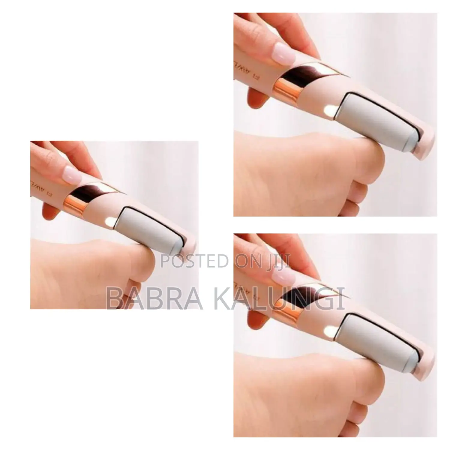 Rechargeable Callus Remover