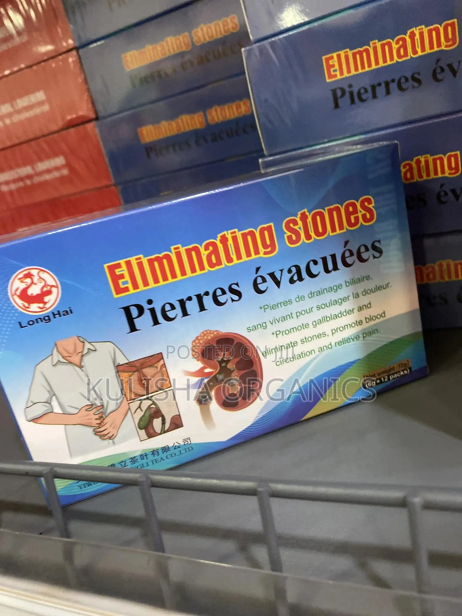 Herbal Solution for Eliminating Kidney and Bladder Stones