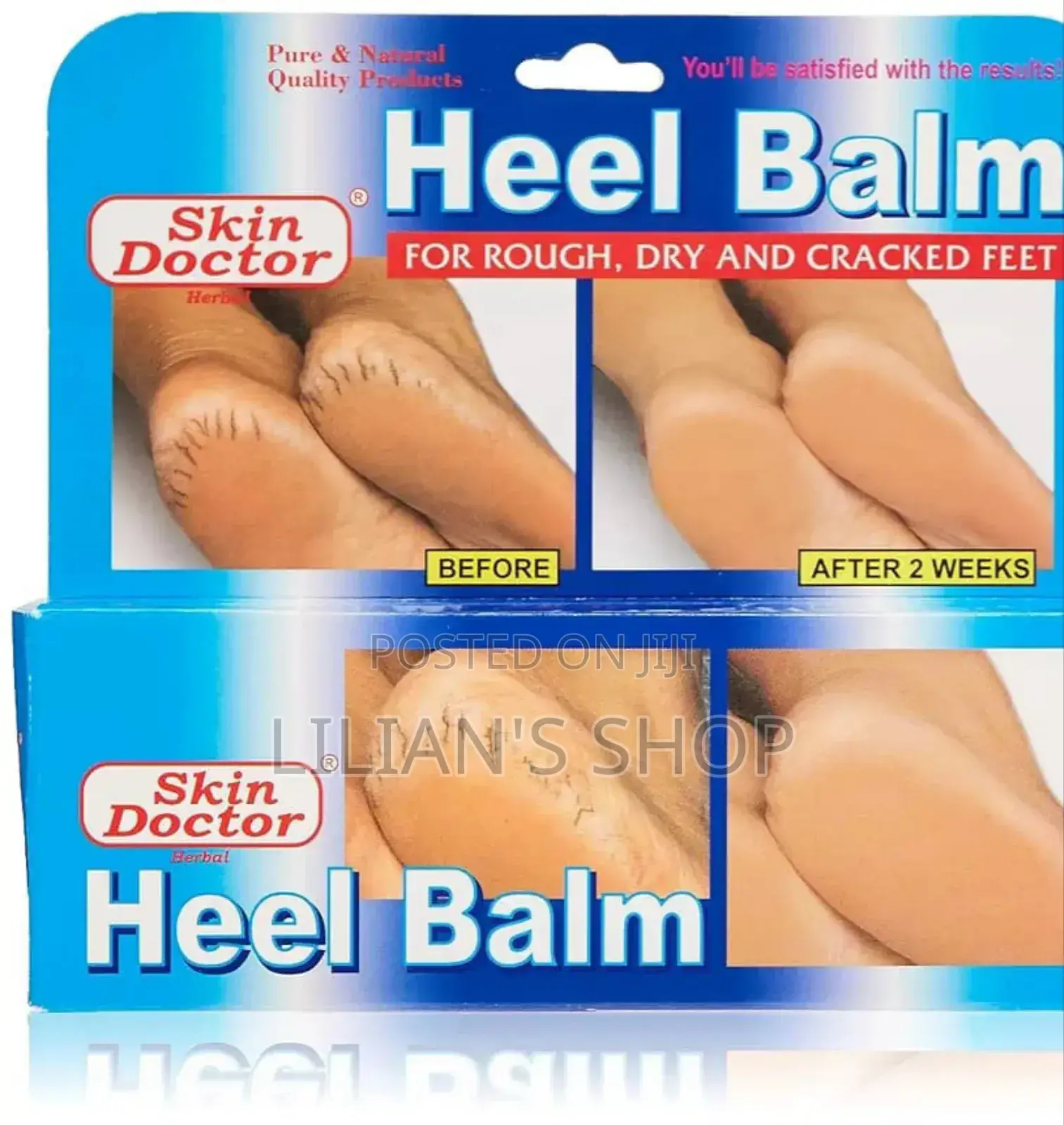 Skin Doctor Herbal Heel Balm