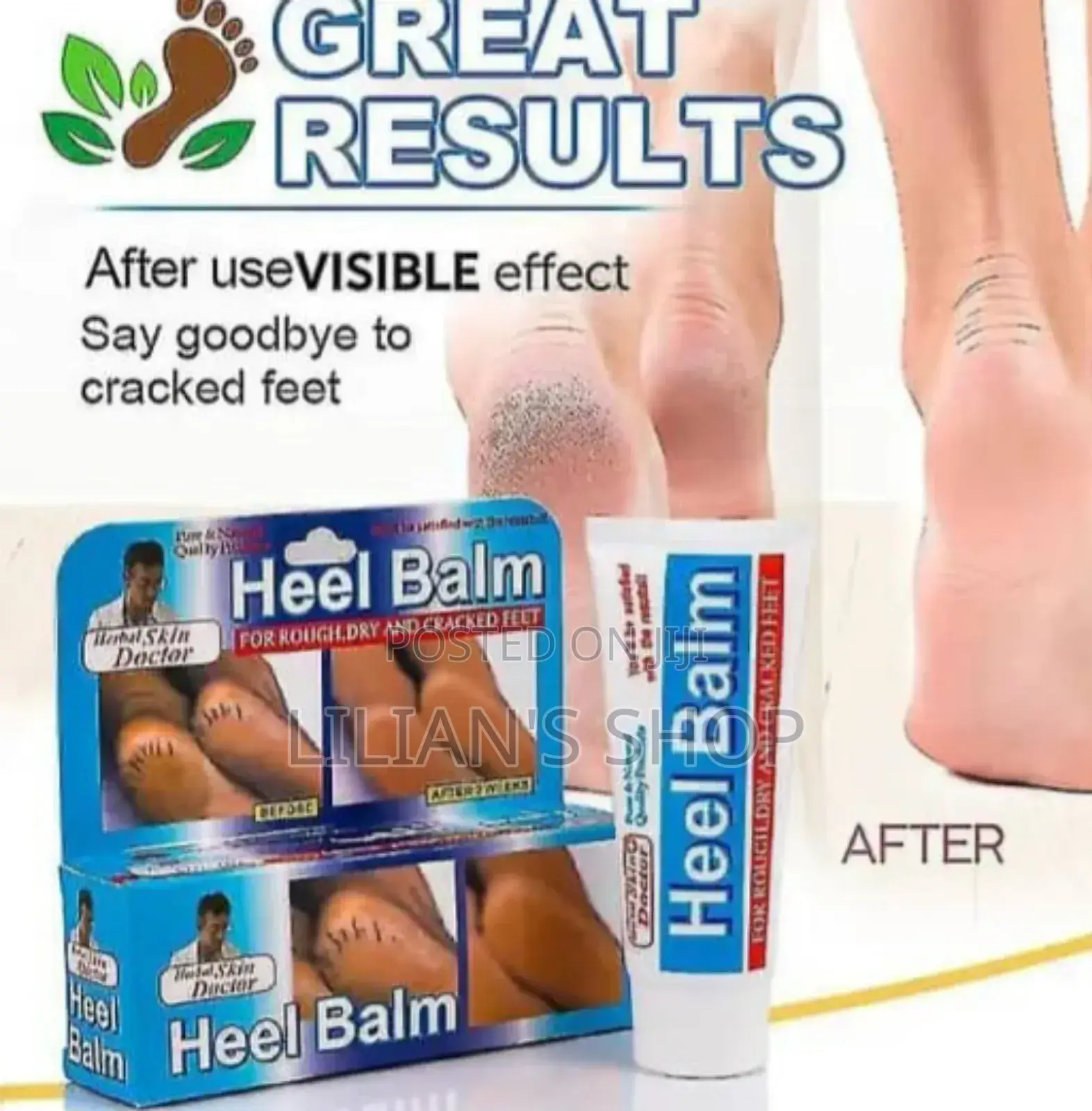 Skin Doctor Herbal Heel Balm
