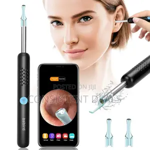 Smart Ear Wax Remover