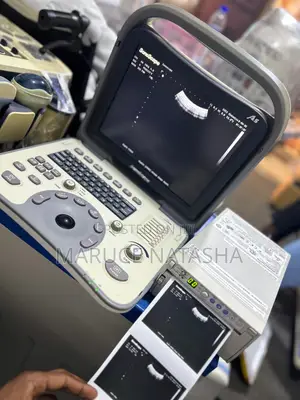 A5 Portable Sonoscape Ultrasound Scan Machine With a Printer