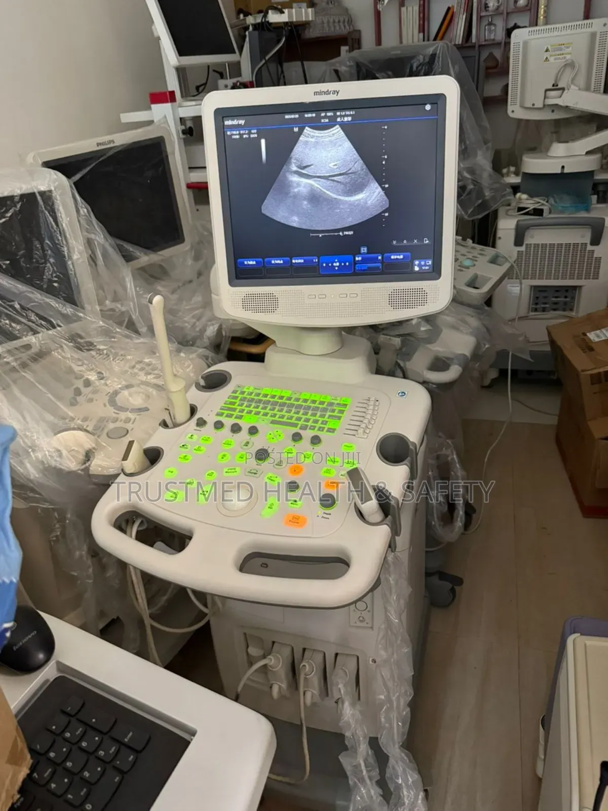 Ultrasound Machine